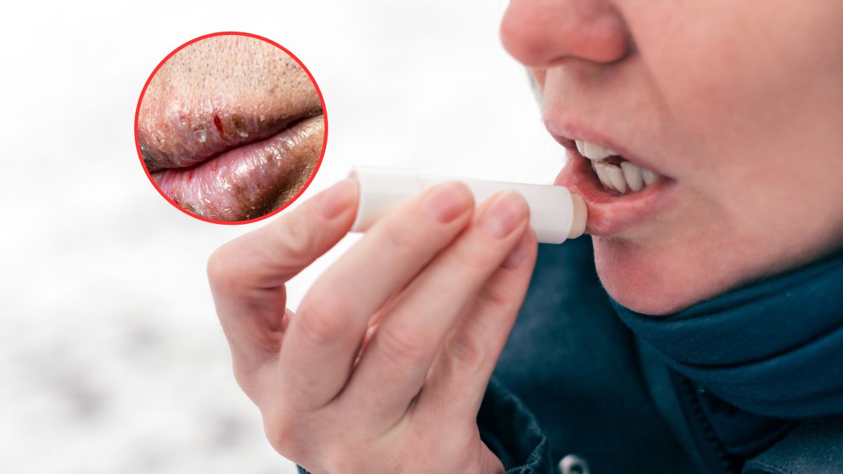 O czym świadczą suche i popękane usta?