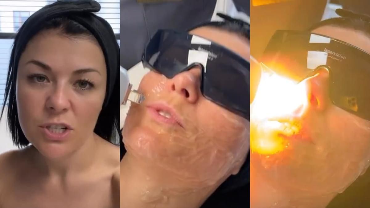 Kasia Cichopek poddała się zabiegowi?