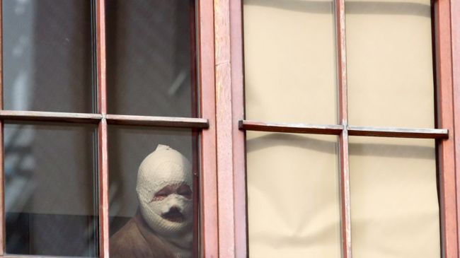 Na zdjęciu jeden z poparzonych górników.