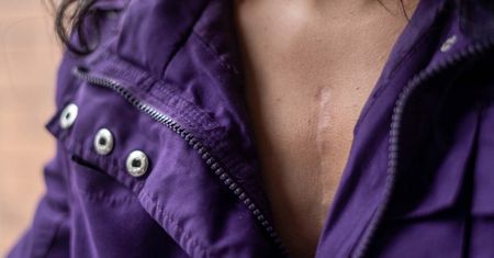 Destrukcyjna dla komórek. Prowadzi do raka, cukrzycy i osteoporozy