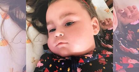 Demencja dziecięca zabija dwuletnią dziewczynkę