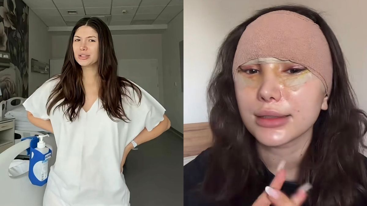 Agata Lewandowska zdradza, ile zapłaciła za lifting