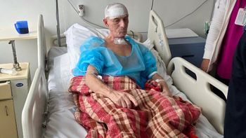 Zbiera pieniądze dla pana Edzia z YT. Miał zgruchotaną czaszkę