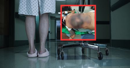 Nie leczyła cukrzycy. Lekarze pokazali, jak wyglądają jej plecy