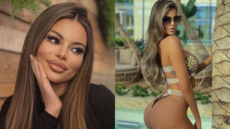 Justyna Gradek zdradza, ile kosztuje zabieg, który wykonała na pośladkach