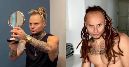 Mateusz Janusz chwali się efektami przeszczepu włosów w Turcji: "W sumie co poradzić, wyglądam ZA*EBIŚCIE" (FOTO)