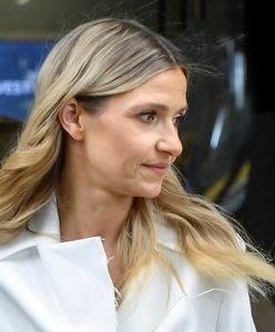 Joanna Koroniewska z powiększonymi ustami. Szybko wyjaśniła, skąd ten efekt