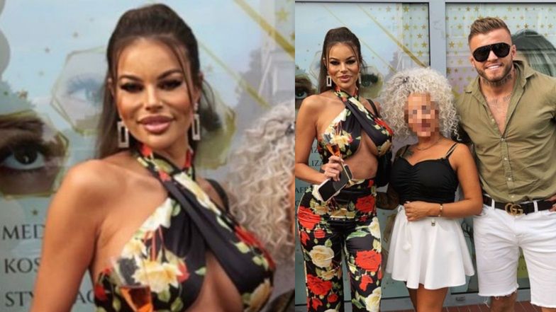 Justyna Gradek i jej eks Karol Miśkiewicz wspólnie promują salon medycyny estetycznej. Przekonali was?