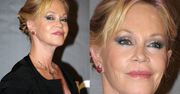 Co się stało z twarzą Melanie Griffith? (ZDJĘCIA)