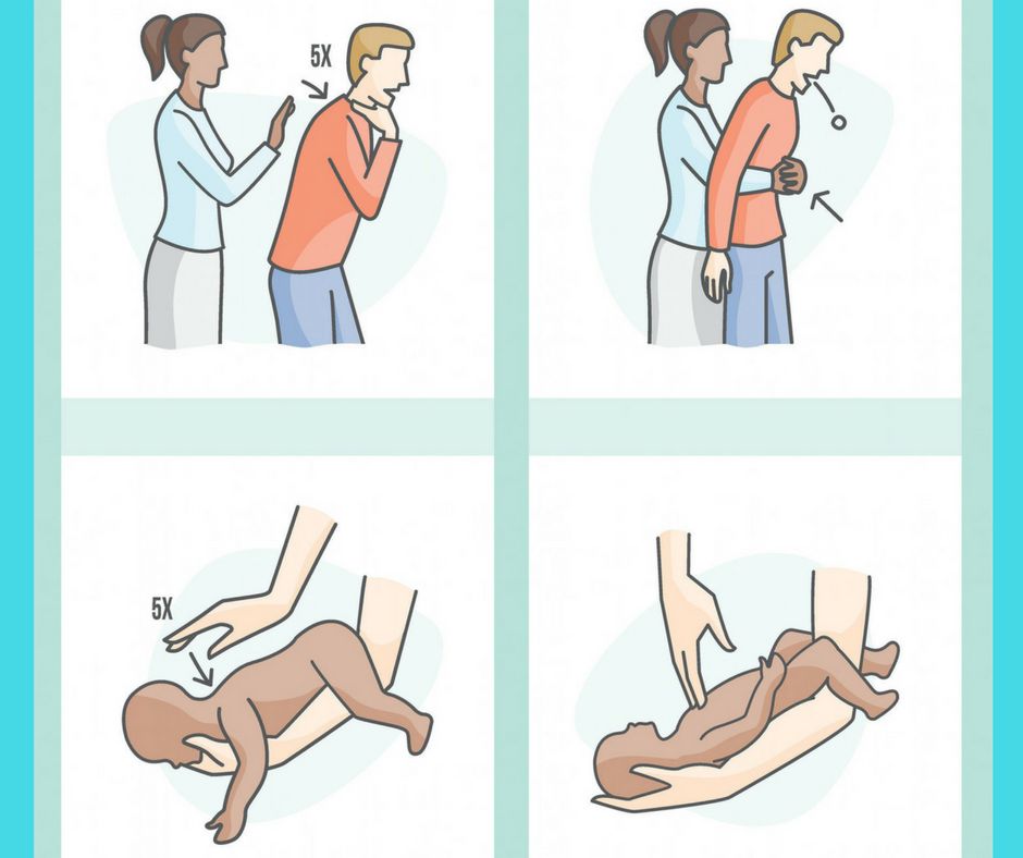 Pierwsza pomoc zakrztuszenie/ Pinterest