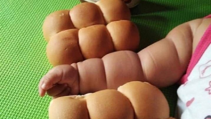 Dzieci są coraz bardziej otyłe. Zdjęcie, które miało być żartem, odsłania szokującą prawdę