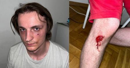 Białoruski muzyk pobity w Warszawie. Usłyszeli, że mówią po rosyjsku