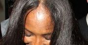Czy Naomi Campbell łysieje?!