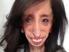 Tajemnicza choroba Lizzie