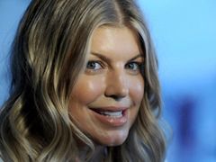 Fergie - co się stało z jej twarzą?