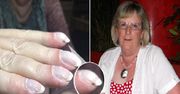 Manicure ocalił 73-latce życie. Zmiany na jej paznokciach były objawem raka płuc