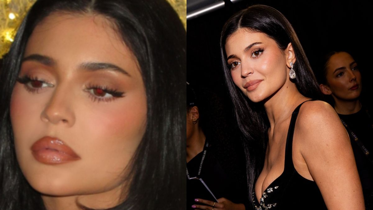 Kylie Jenner zmniejszyła usta