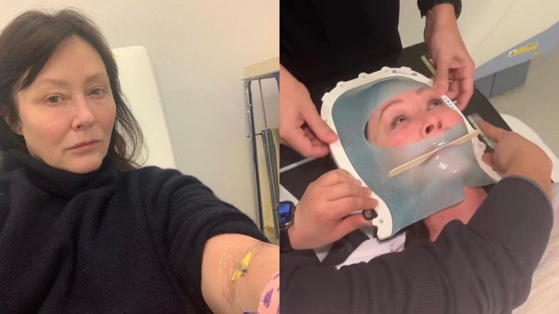Przerzuty do mózgu zdiagnozowane u Shannen Doherty