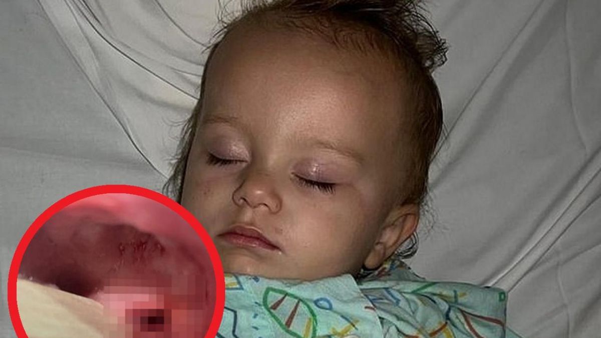 Myła zęby. Szczoteczka wbiła jej się w gardło. "Z ust ciekła krew"
