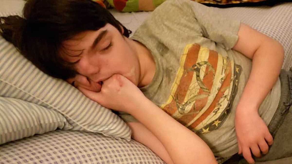 Tres Johnson przyszedł na świat z rzadką wadą wrodzoną