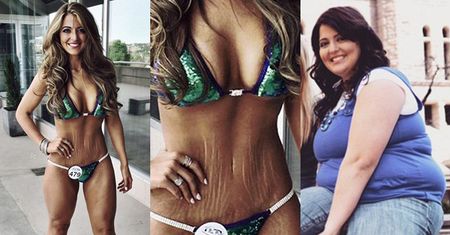 Amerykanka schudła 59 kilogramów i wygrała konkurs bikini: "Chwalę się BLIZNAMI I ROZSTĘPAMI!"
