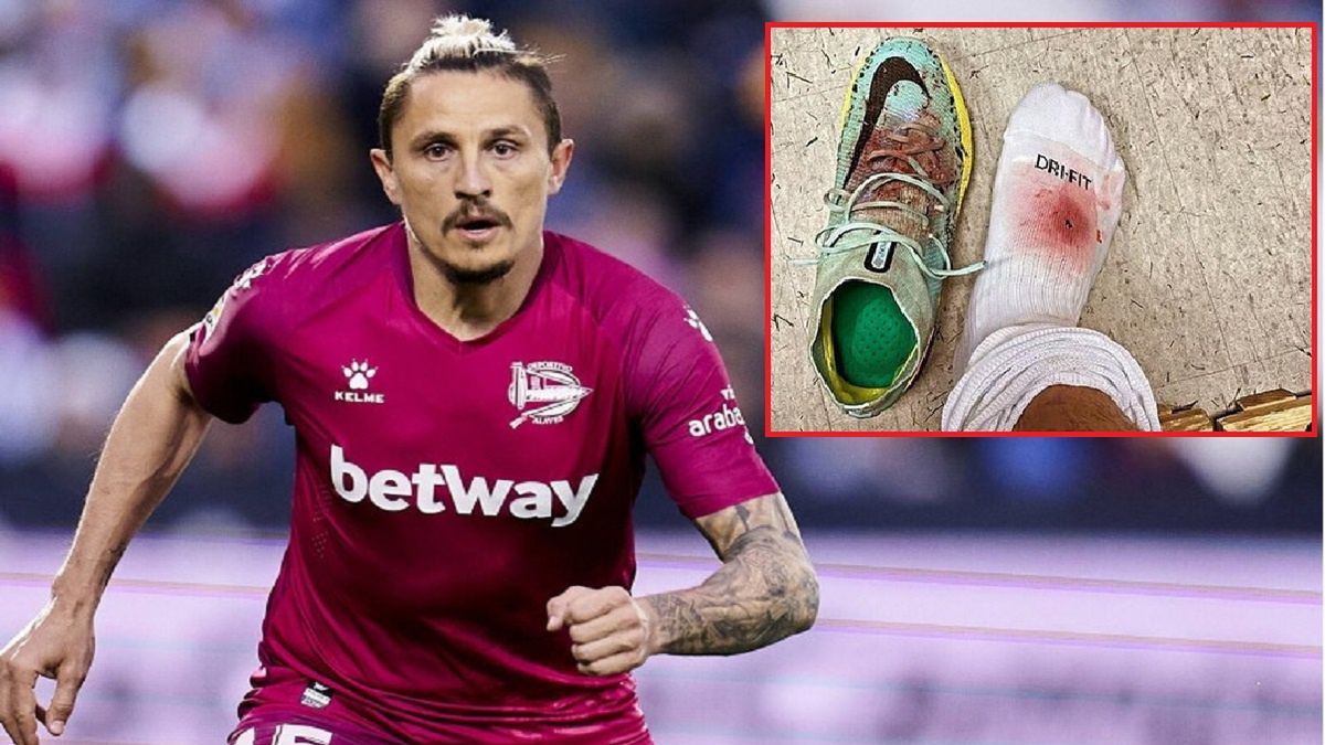 Ljubomir Fejsa ucierpiał w meczu z 1.FC Koeln