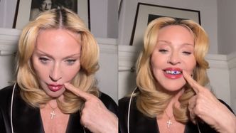 Madonna prezentuje diamentowe uzębienie, siedząc na sedesie. Fajnie?