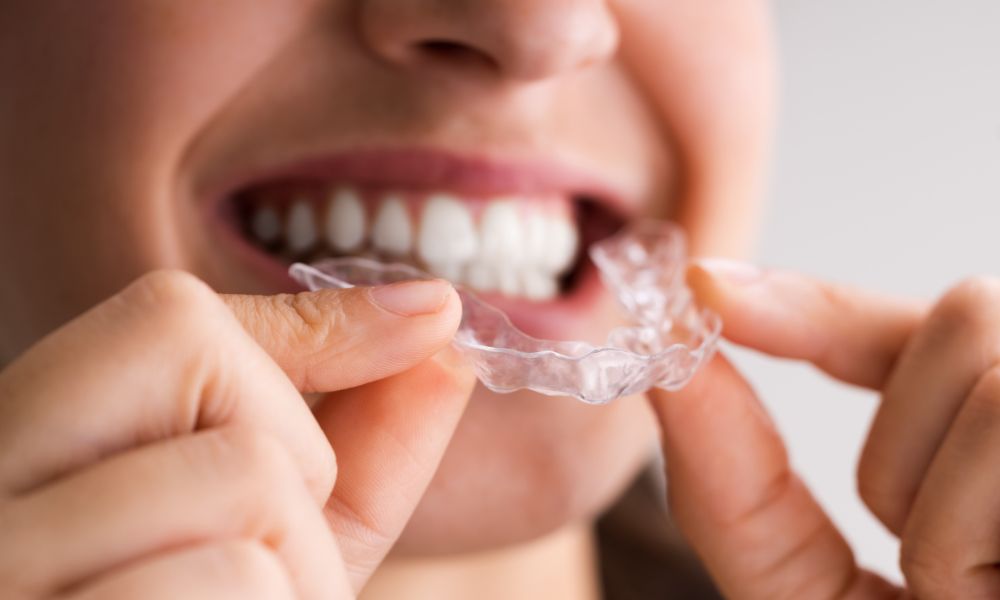 Burza wokół nakładkowych systemów do prostowania zębów.