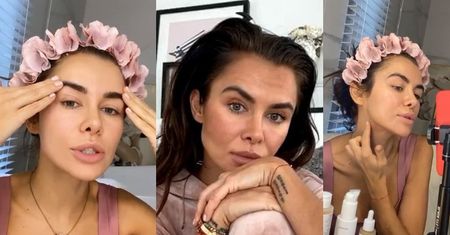 Dumna Natalia Siwiec prezentuje twarz po zabiegu retinolem: "Jest taka napięta wręcz, jak po BOTOKSIE"