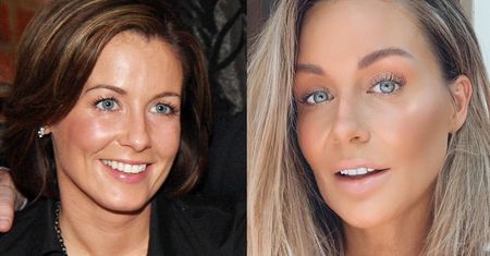 Małgorzata Rozenek wpłaci 100 TYSIĘCY na cele charytatywne, jeśli ktoś udowodni, że ma LICÓWKI. Podejmujecie wyzwanie?