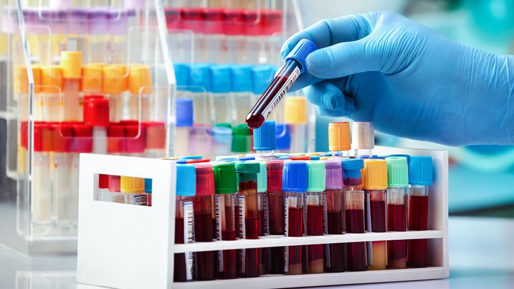 Konflikt serologiczny może skutkować m.in. chorobą hemolityczną