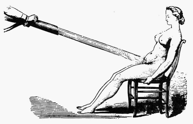 Rycina z 1860 roku pokazująca, jak przeprowadzać masaż wodny
