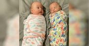 Urodziła wyjątkowe bliźnięta. Lekarze mówią, że to cud