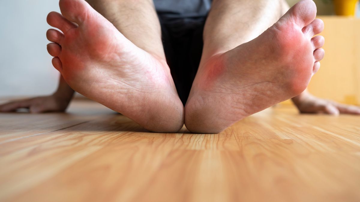 Odparzone stopy wymagają szybkiej reakcji