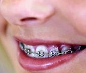 Słownik slangu nastolatków