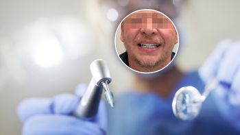 Tego się w klinice nie spodziewali. Zrobili mu zęby, a on się zawinął