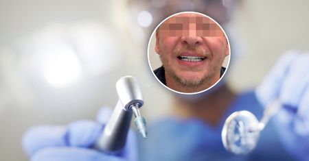 Naprawił zęby i nie zapłacił. Próbują odzyskać 30 tys. zł