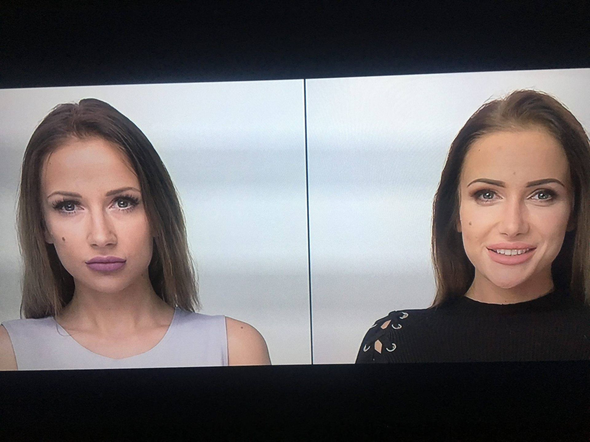 Eliza z Warsaw Shore zoperowała nos w programie "Życie bez wstydu"