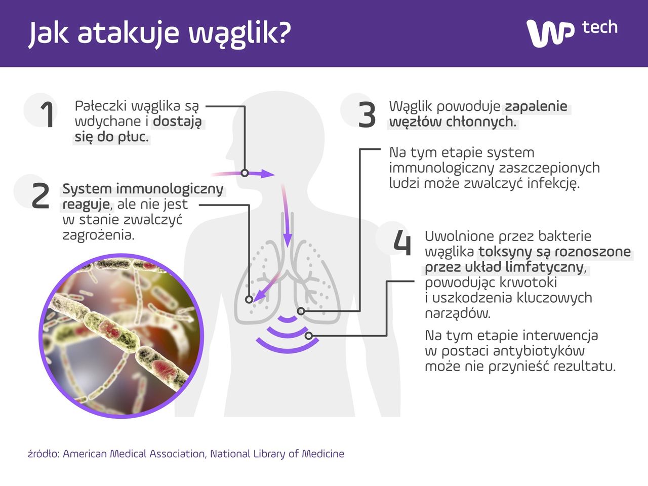 Tak zabija wąglik