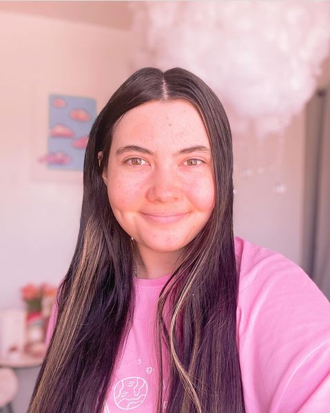 25-letnia Tessa Hansen-Smith jest uczulona na wodę