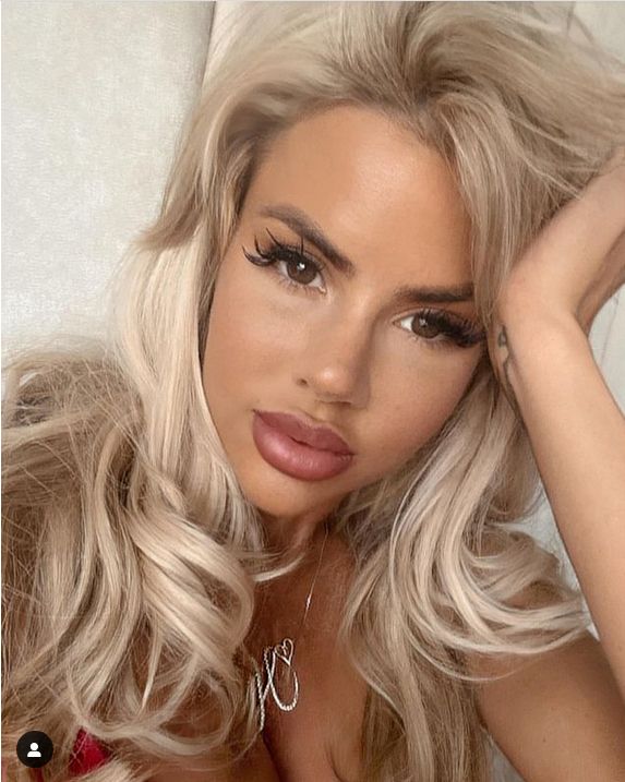Hannah Elizabeth na zdjęciu tuż przed operacjami