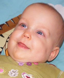 Małej Amelce grozi amputacja ramienia. Rodzice proszą o pomoc