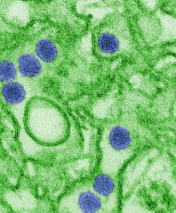 Pierwsze zakażenia wirusem Zika w USA od żyjących tam komarów