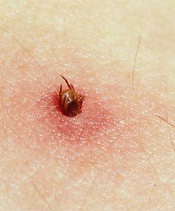 Walka z boreliozą na ostatniej prostej. Śląscy naukowcy o krok od przełomowego odkrycia