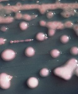 Superbakteria znów atakuje? Sanepid uspokaja, lekarze apelują: czas ogłosić epidemię