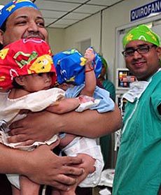 Bliźniaczki syjamskie rozdzielone