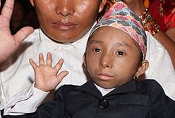 Ma 17 lat i mierzy 51 cm