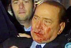 Berlusconi zaatakowany