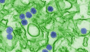 Pierwsze dwa potwierdzone zakażenia wirusem Zika w Polsce