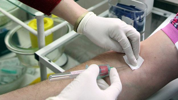 Warto się badać i dbać o profilaktykę, by nie doszło do zakażenia HIV